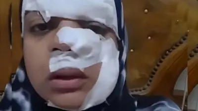 حبس زوج تشويه وجه زوجته بالموس لرفعها دعوى خلع بالغربية 4 أيام
