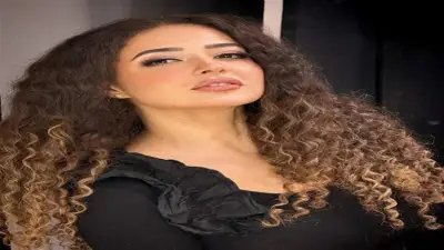 إصابة ندى أكرم بعد سقوطها من الاسكوتر.. رسالة تحذير للجمهور