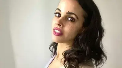 نور دياب تكشف معاناتها مع الحساسية: بقت عندي من كل حاجة
