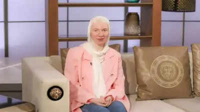 في يوم التوعية بالمهق.. قصص كفاح وأمل لمرضى الألبينو في مصر