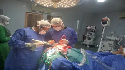 جراحات دقيقة تنقذ شابا وطفلا من الموت المحقق بمستشفى قويسنا في المنوفية