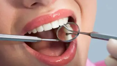 دراسة: الصيام يُحسّن صحة اللثة ويُقلّل الالتهابات بشكل ملحوظ