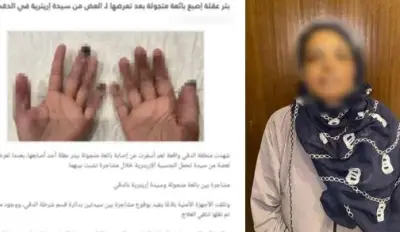 ضبط بائعة جائلة قطعت إصبع طفلة بسبب بكائها في القليوبية