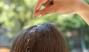 4 وصفات طبيعية سحرية لحماية الشعر من الجفاف في الصيف