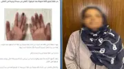 القبض على بائعة متجولة أجنبية قامت بقضم يد أخرى مما أدى لبتر طرف من أصابعها