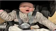مرض نادر يمنع رضيعة بريطانية من الضحك ويجبرها على تركيب أنبوب تغذية