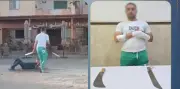 خلاف على معاكسة فتاة يتطور إلى مشاجرة وقطع يد شاب في الإسكندرية