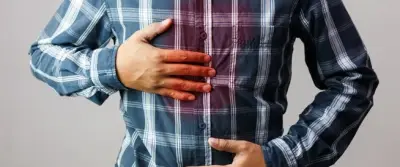 كيف تحمي معدتك من الحموضة وارتجاع المريء في الحر؟